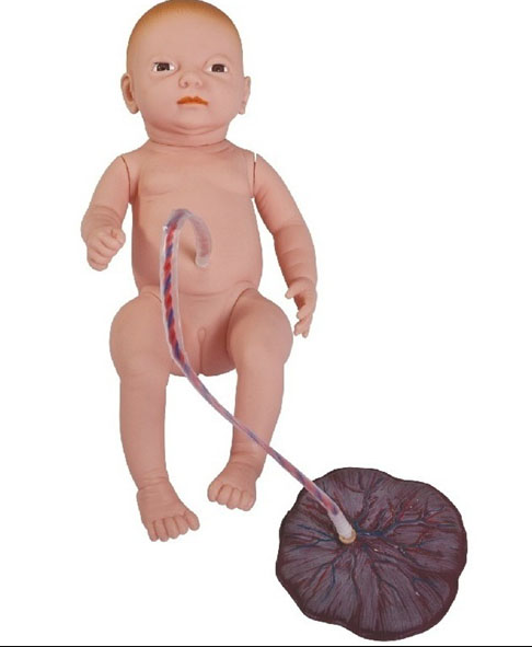 Neonatal UmbilicalCord Nursing Model