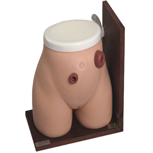 Ostomy Nursing Model