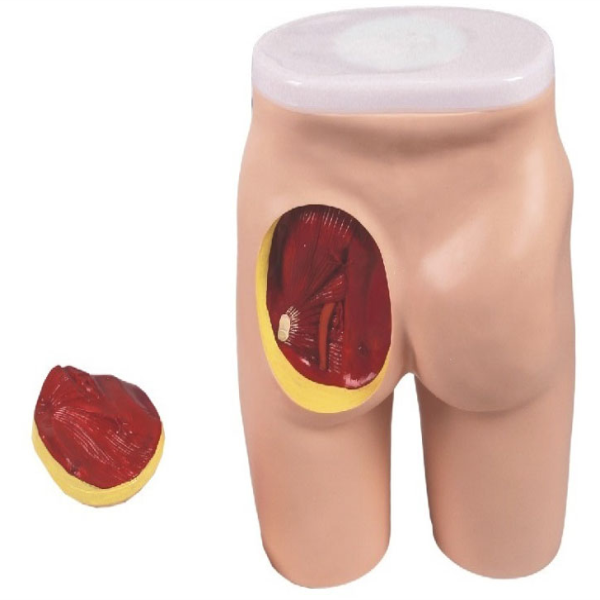 Buttocks Intramuscular Injection & Anatomic Structure Model