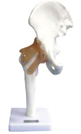 Hip Joint with Ligament Model