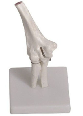 Elbow Joint Model