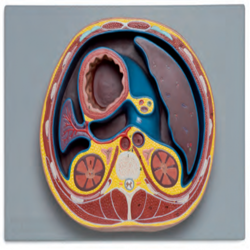  腹腔横断模型