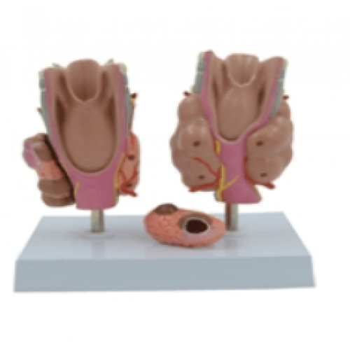 甲状腺病理模型